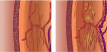 Image showing vessels in eyes